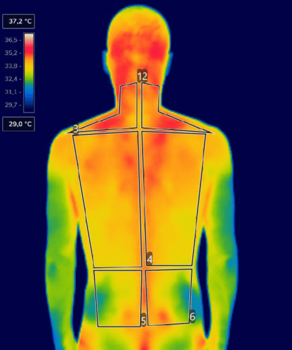 termografia clínica