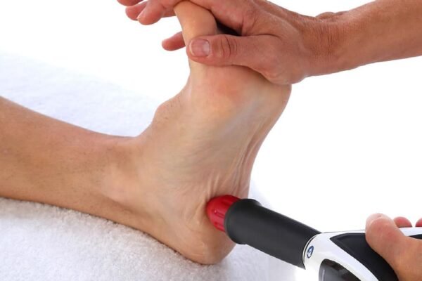 ondas de choque fascite plantar